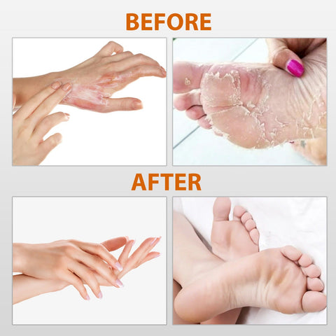 Soft & Smooth Feet Peel Mask