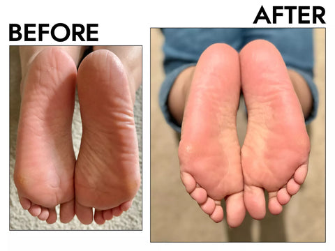 Soft & Smooth Feet Peel Mask